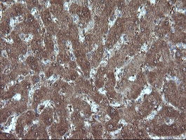 MMACHC Antibody - IHC of paraffin-embedded Human liver tissue using anti-MMACHC mouse monoclonal antibody. (Heat-induced epitope retrieval by 10mM citric buffer, pH6.0, 100C for 10min).