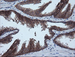 MMACHC Antibody - IHC of paraffin-embedded Human prostate tissue using anti-MMACHC mouse monoclonal antibody. (Heat-induced epitope retrieval by 10mM citric buffer, pH6.0, 100C for 10min).