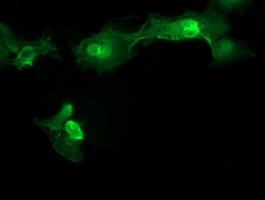 MMACHC Antibody - Anti-MMACHC mouse monoclonal antibody immunofluorescent staining of COS7 cells transiently transfected by pCMV6-ENTRY MMACHC.