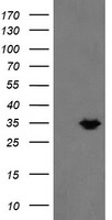 MMACHC Antibody - HEK293T cells were transfected with the pCMV6-ENTRY control (Left lane) or pCMV6-ENTRY MMACHC (Right lane) cDNA for 48 hrs and lysed. Equivalent amounts of cell lysates (5 ug per lane) were separated by SDS-PAGE and immunoblotted with anti-MMACHC.