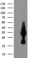 MMACHC Antibody - HEK293T cells were transfected with the pCMV6-ENTRY control (Left lane) or pCMV6-ENTRY MMACHC (Right lane) cDNA for 48 hrs and lysed. Equivalent amounts of cell lysates (5 ug per lane) were separated by SDS-PAGE and immunoblotted with anti-MMACHC.