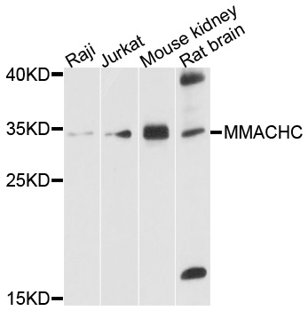 MMACHC Antibody - Western blot analysis of extracts of various cell lines, using MMACHC antibody at 1:1000 dilution. The secondary antibody used was an HRP Goat Anti-Rabbit IgG (H+L) at 1:10000 dilution. Lysates were loaded 25ug per lane and 3% nonfat dry milk in TBST was used for blocking. An ECL Kit was used for detection and the exposure time was 20s.
