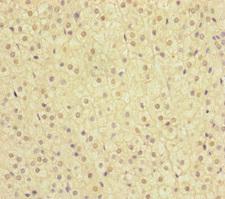 MMACHC Antibody - Immunohistochemistry of paraffin-embedded human adrenal gland tissue at dilution of 1:100