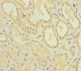 MMACHC Antibody - Immunohistochemistry of paraffin-embedded human kidney tissue at dilution of 1:100