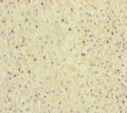 MMACHC Antibody - Immunohistochemistry of paraffin-embedded human adrenal gland tissue at dilution of 1:100