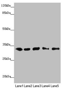 MMACHC Antibody - Western blot All Lanes: MMACHC antibody at 5.16 ug/ml Lane 1: HepG-2 whole cell lysate Lane 2: K562 whole cell lysate Lane 3: A549 whole cell lysate Lane 4: Hela whole cell lysate Lane 5: Raji whole cell lysate Secondary Goat polyclonal to rabbit IgG at 1/10000 dilution Predicted band size: 32 kDa Observed band size: 32 kDa