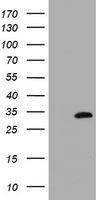 MMADHC / C2orf25 Antibody - HEK293T cells were transfected with the pCMV6-ENTRY control (Left lane) or pCMV6-ENTRY MMADHC (Right lane) cDNA for 48 hrs and lysed. Equivalent amounts of cell lysates (5 ug per lane) were separated by SDS-PAGE and immunoblotted with anti-MMADHC.