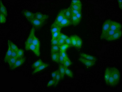 MMADHC / C2orf25 Antibody - Immunofluorescence staining of HepG2 cells at a dilution of 1:100, counter-stained with DAPI. The cells were fixed in 4% formaldehyde, permeabilized using 0.2% Triton X-100 and blocked in 10% normal Goat Serum. The cells were then incubated with the antibody overnight at 4 °C.The secondary antibody was Alexa Fluor 488-congugated AffiniPure Goat Anti-Rabbit IgG (H+L) .