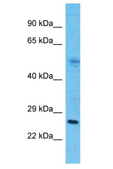 MMD2 Antibody - MMD2 antibody Western Blot of Thymus Tumor. Antibody dilution: 1 ug/ml.  This image was taken for the unconjugated form of this product. Other forms have not been tested.