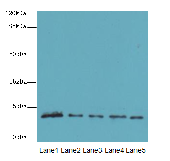 MMD2 Antibody - Western blot. All lanes: MMD2 antibody at 3 ug/ml. Lane 1: Mouse brain tissue. Lane 2: Mouse kidney tissue. Lane 3: U251 whole cell lysate. Lane 4: 293T whole cell lysate. Lane 5: Mouse liver tissue. Secondary Goat polyclonal to Rabbit IgG at 1:10000 dilution. Predicted band size: 31 kDa. Observed band size: 23 kDa.