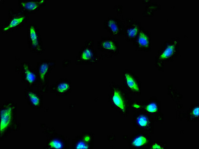 MMD2 Antibody - Immunofluorescent analysis of U251 cells using MMD2 Antibody at dilution of 1:100 and Alexa Fluor 488-congugated AffiniPure Goat Anti-Rabbit IgG(H+L)