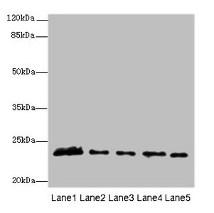 MMD2 Antibody - Western blot All lanes: MMD2 antibody at 3µg/ml Lane 1: Mouse brain tissue Lane 2: Mouse kidney tissue Lane 3: U251 whole cell lysate Lane 4: 293T whole cell lysate Lane 5: Mouse liver tissue Secondary Goat polyclonal to rabbit IgG at 1/10000 dilution Predicted band size: 32, 29, 23 kDa Observed band size: 23 kDa