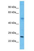 MMD2 Antibody - MMD2 antibody Western Blot of Thymus Tumor. Antibody dilution: 1 ug/ml.  This image was taken for the unconjugated form of this product. Other forms have not been tested.