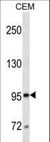 MME / CD10 Antibody - MME/CD10 western blot of CEM cell line lysates (35 ug/lane). The MME/CD10 antibody detected the MME/CD10 protein (arrow).