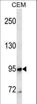 MME / CD10 Antibody - MME/CD10 Antibody western blot of CEM cell line lysates (35 ug/lane). The MME/CD10 antibody detected the MME/CD10 protein (arrow).