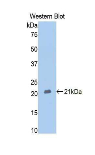 MME / CD10 Antibody - Western blot of recombinant MME / CD10.  This image was taken for the unconjugated form of this product. Other forms have not been tested.