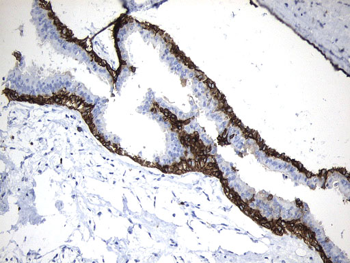 MME / CD10 Antibody - Immunohistochemical staining of paraffin-embedded Human breast tissue within the normal limits using anti-MME. (CD10) mouse monoclonal antibody. (Heat-induced epitope retrieval by 1mM EDTA in 10mM Tris buffer. (pH9.0) at 120°C for 3 min. (1:600)