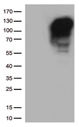 MME / CD10 Antibody - HEK293T cells were transfected with the pCMV6-ENTRY control. (Left lane) or pCMV6-ENTRY MME. (Right lane) cDNA for 48 hrs and lysed. Equivalent amounts of cell lysates. (5 ug per lane) were separated by SDS-PAGE and immunoblotted with anti-MME. (1:500)