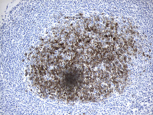 MME / CD10 Antibody - Immunohistochemical staining of paraffin-embedded Human tonsil within the normal limits using anti-MME. (CD10) mouse monoclonal antibody. (Heat-induced epitope retrieval by 1mM EDTA in 10mM Tris buffer. (pH9.0) at 120°C for 3 min. (1:600)