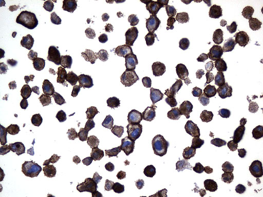 MME / CD10 Antibody - Immunohistochemical staining of paraffin-embedded SK-MEL-28 cell pellets using anti-MME. (CD10) mouse monoclonal antibody. (Heat-induced epitope retrieval by 1mM EDTA in 10mM Tris buffer. (pH9.0) at 120°C for 2.5 min. (1:600)