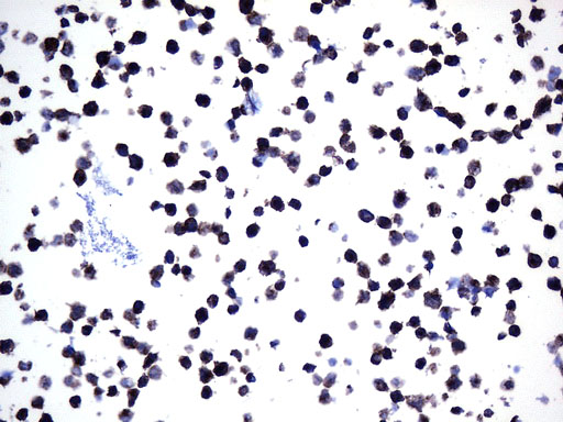 MME / CD10 Antibody - Immunohistochemical staining of paraffin-embedded Ramos cell pellets using anti-MME. (CD10) mouse monoclonal antibody. (Heat-induced epitope retrieval by 1mM EDTA in 10mM Tris buffer. (pH9.0) at 120°C for 2.5 min. (1:600)