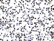 MME / CD10 Antibody - Immunohistochemical staining of paraffin-embedded Raji cell pellets using anti-MME. (CD10) mouse monoclonal antibody. (Heat-induced epitope retrieval by 1mM EDTA in 10mM Tris buffer. (pH9.0) at 120°C for 2.5 min. (1:600)