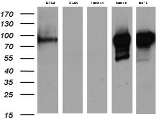 MME / CD10 Antibody - Western blot analysis of extracts. (35ug) from 5 different cancer cell lines by using anti-MME. (CD10) monoclonal antibody. (1:500)