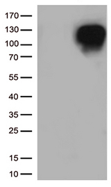 MME / CD10 Antibody - HEK293T cells were transfected with the pCMV6-ENTRY control. (Left lane) or pCMV6-ENTRY MME. (Right lane) cDNA for 48 hrs and lysed. Equivalent amounts of cell lysates. (5 ug per lane) were separated by SDS-PAGE and immunoblotted with anti-MME. (1:500)
