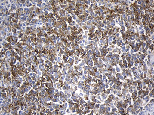 MME / CD10 Antibody - Immunohistochemical staining of paraffin-embedded Human tonsil within the normal limits using anti-MME. (CD10) mouse monoclonal antibody. (Heat-induced epitope retrieval by 1mM EDTA in 10mM Tris buffer. (pH8.5) at 120°C for 3 min. (1:600)