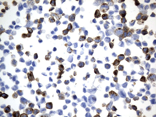 MME / CD10 Antibody - Immunohistochemical staining of paraffin-embedded MDA-MB-453 cell pellets using anti-MME. (CD10) mouse monoclonal antibody. (Heat-induced epitope retrieval by 1mM EDTA in 10mM Tris buffer. (pH9.0) at 120°C for 2.5 min. (1:600)