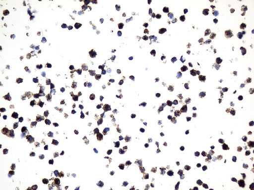 MME / CD10 Antibody - Immunohistochemical staining of paraffin-embedded Ramos cell pellets using anti-MME. (CD10) mouse monoclonal antibody. (Heat-induced epitope retrieval by 1mM EDTA in 10mM Tris buffer. (pH9.0) at 120°C for 2.5 min. (1:600)
