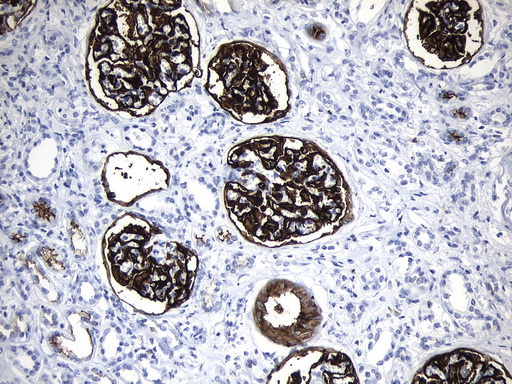 MME / CD10 Antibody - Immunohistochemical staining of paraffin-embedded Human Kidney tissue within the normal limits using anti-MME. (CD10) mouse monoclonal antibody. (Heat-induced epitope retrieval by 1mM EDTA in 10mM Tris buffer. (pH9.0) at 120°C for 3 min. (1:600)