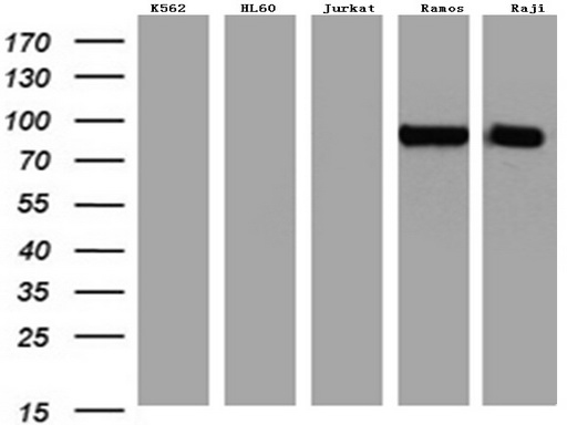 MME / CD10 Antibody - Western blot analysis of extracts. (35ug) from 5 different cancer cell lines by using anti-MME. (CD10) monoclonal antibody. (1:500)