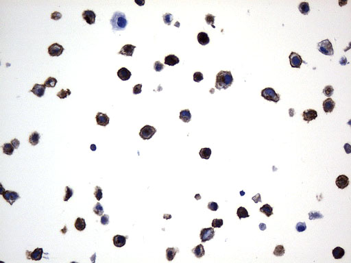 MME / CD10 Antibody - Immunohistochemical staining of paraffin-embedded NCI-H1650 cell pellets using anti-MME. (CD10) mouse monoclonal antibody. (Heat-induced epitope retrieval by 1mM EDTA in 10mM Tris buffer. (pH9.0) at 120°C for 2.5 min. (1:600)