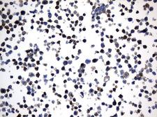 MME / CD10 Antibody - Immunohistochemical staining of paraffin-embedded Raji cell pellets using anti-MME. (CD10) mouse monoclonal antibody. (Heat-induced epitope retrieval by 1mM EDTA in 10mM Tris buffer. (pH9.0) at 120°C for 2.5 min. (1:600)
