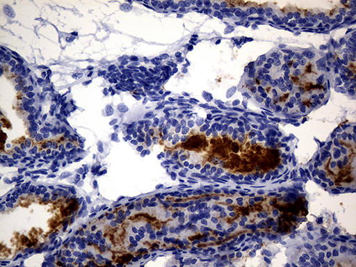 MME / CD10 Antibody - Immunohistochemical staining of paraffin-embedded mouse bladder tissue using anti-MME. (CD10) clone UMAB236 mouse monoclonal antibody. (Heat-induced epitope retrieval by 1mM EDTA in 10mM Tris buffer. (pH8.5) at 120°C for 3 min. (1:600).