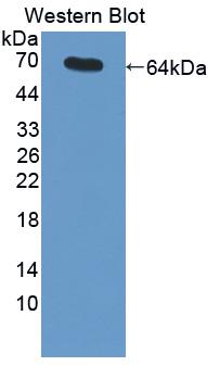 MME / CD10 Antibody - Western blot of NEP / DDR1 antibody.