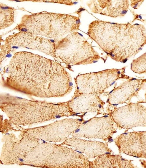 MME / CD10 Antibody - Immunohistochemical of paraffin-embedded H. skeletal muscle section using MME Antibody. Antibody was diluted at 1:25 dilution. A peroxidase-conjugated goat anti-rabbit IgG at 1:400 dilution was used as the secondary antibody, followed by DAB staining.