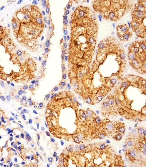 MME / CD10 Antibody - Immunohistochemical of paraffin-embedded H. kidney section using MME Antibody. Antibody was diluted at 1:25 dilution. A peroxidase-conjugated goat anti-rabbit IgG at 1:400 dilution was used as the secondary antibody, followed by DAB staining.