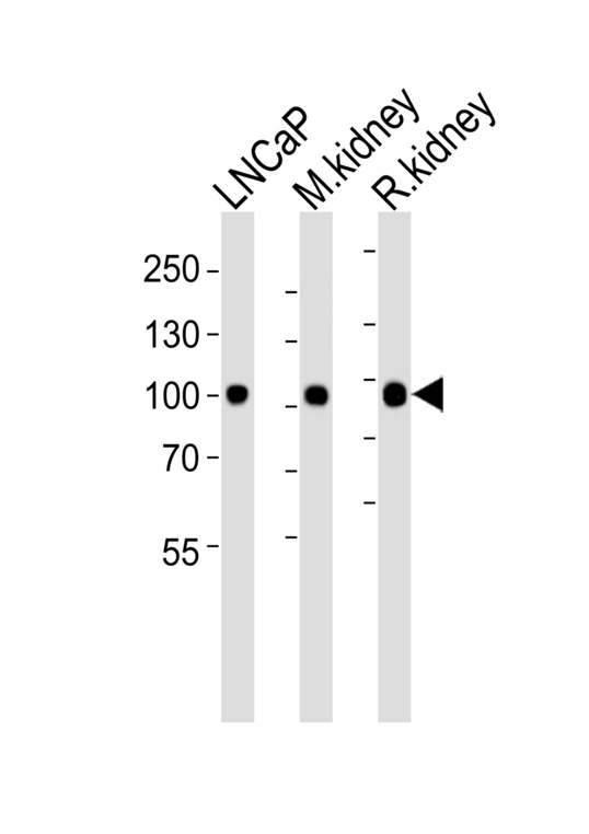 MME / CD10 Antibody - Western blot of lysates from LNCaP cell line , mouse kidney, rat kidney tissue lysate (from left to right) with MME Antibody. Antibody was diluted at 1:1000 at each lane. A goat anti-rabbit IgG H&L (HRP) at 1:5000 dilution was used as the secondary antibody. Lysates at 35 ug per lane.