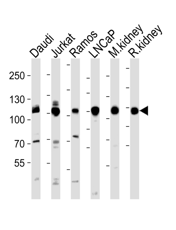 MME / CD10 Antibody - Western blot of lysates from Daudi, Jurkat, Ramos, LNCaP cell line, mouse kidney, rat kidney tissue lysate (from left to right) with MME Antibody. Antibody was diluted at 1:1000 at each lane. A goat anti-rabbit IgG H&L (HRP) at 1:5000 dilution was used as the secondary antibody. Lysates at 35 ug per lane.