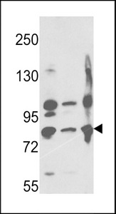 MME / CD10 Antibody - Western blot of Neprilysin Antibody in A2058,A375,Ramos cell line lysates (35 ug/lane). EPN (arrow) was detected using the purified antibody.