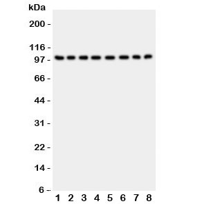 MME / CD10 Antibody - Western blot testing of CD10 antibody and Lane 1: rat kidney; 2: (r) brain; 3: (r) liver; 4: human placenta; 5: (h) HeLa; 6: (h) Jurkat; 7: (h) Raji; 8: (h) 293T lysate; Routinely visualized at ~100KD