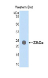 MME / CD10 Antibody - Western blot of recombinant MME / CD10.  This image was taken for the unconjugated form of this product. Other forms have not been tested.