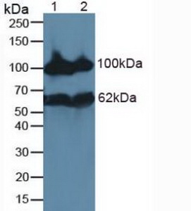 MME / CD10 Antibody - Western Blot; Lane1: Rat Kidney Tissue; Lane2: Mouse Kidney Tissue.