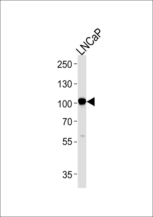 MME / CD10 Antibody - MME Antibody western blot of LNCaP cell line lysates (35 ug/lane). The MME antibody detected the MME protein (arrow).