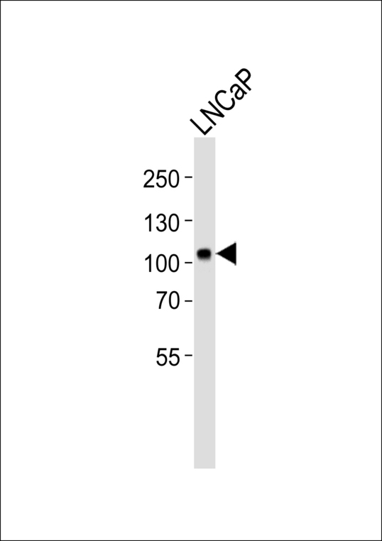 MME / CD10 Antibody - Western blot of lysate from LNCaP cell line with MME Antibody. Antibody was diluted at 1:1000. A goat anti-rabbit IgG H&L (HRP) at 1:5000 dilution was used as the secondary antibody. Lysate at 35 ug.