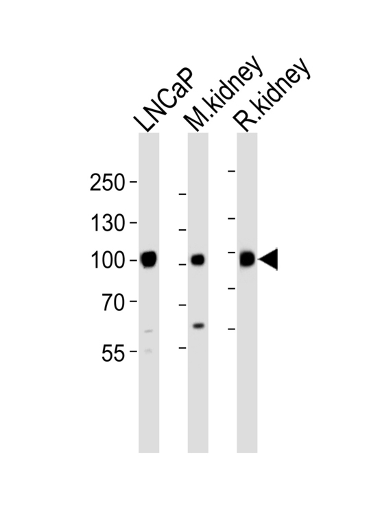 MME / CD10 Antibody - Western blot of lysates from LNCaP, M. kidney, R. kidney cell line (from left to right) with MME Antibody. Antibody was diluted at 1:1000 at each lane. A goat anti-rabbit IgG H&L (HRP) at 1:5000 dilution was used as the secondary antibody. Lysates at 35 ug per lane.