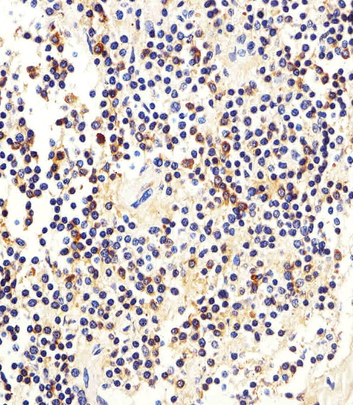 MME / CD10 Antibody - Immunohistochemical of paraffin-embedded H. spleen section using MME Antibody. Antibody was diluted at 1:25 dilution. A peroxidase-conjugated goat anti-rabbit IgG at 1:400 dilution was used as the secondary antibody, followed by DAB staining.