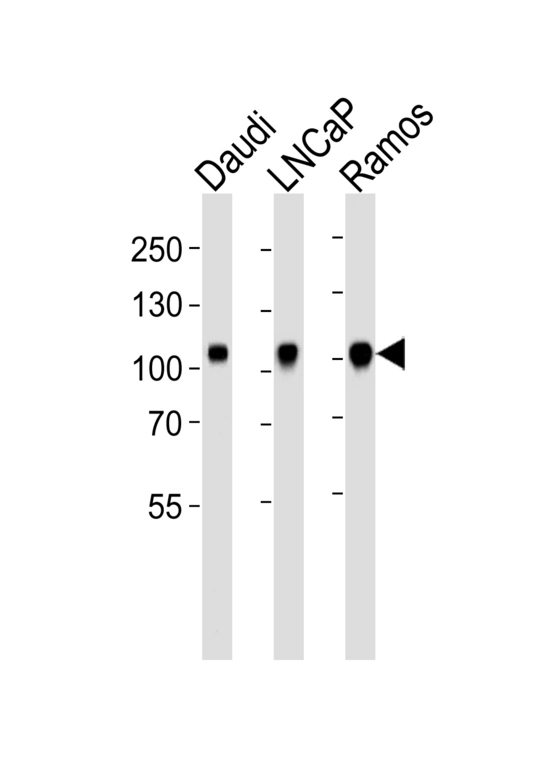 MME / CD10 Antibody - Western blot of lysates from Daudi, LNCaP, Ramos cell line (from left to right) with MME Antibody. Antibody was diluted at 1:1000 at each lane. A goat anti-rabbit IgG H&L (HRP) at 1:5000 dilution was used as the secondary antibody. Lysates at 35 ug per lane.